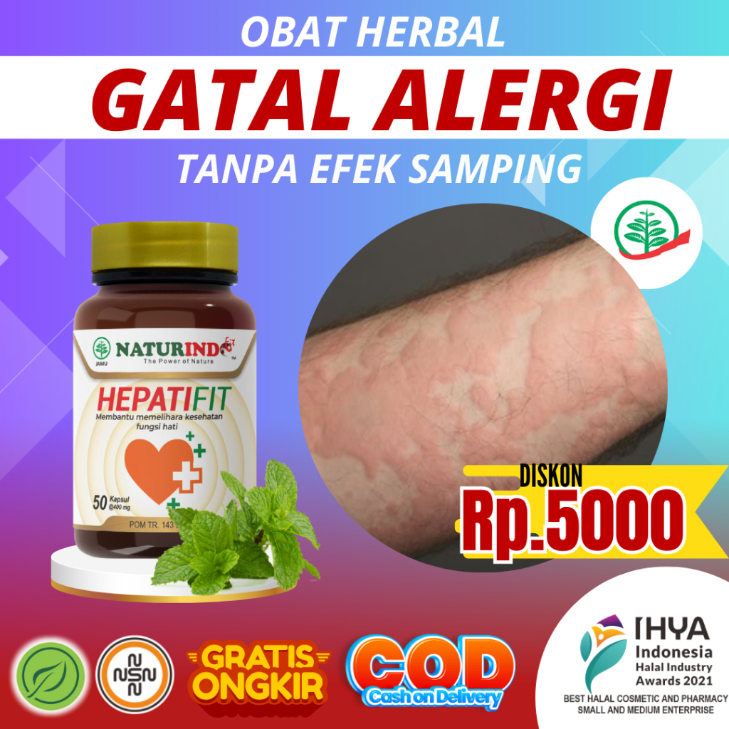 Mengatasi Alergi Gatal Dengan Obat Herbal Alami: Panduan Lengkap Dan Efektif