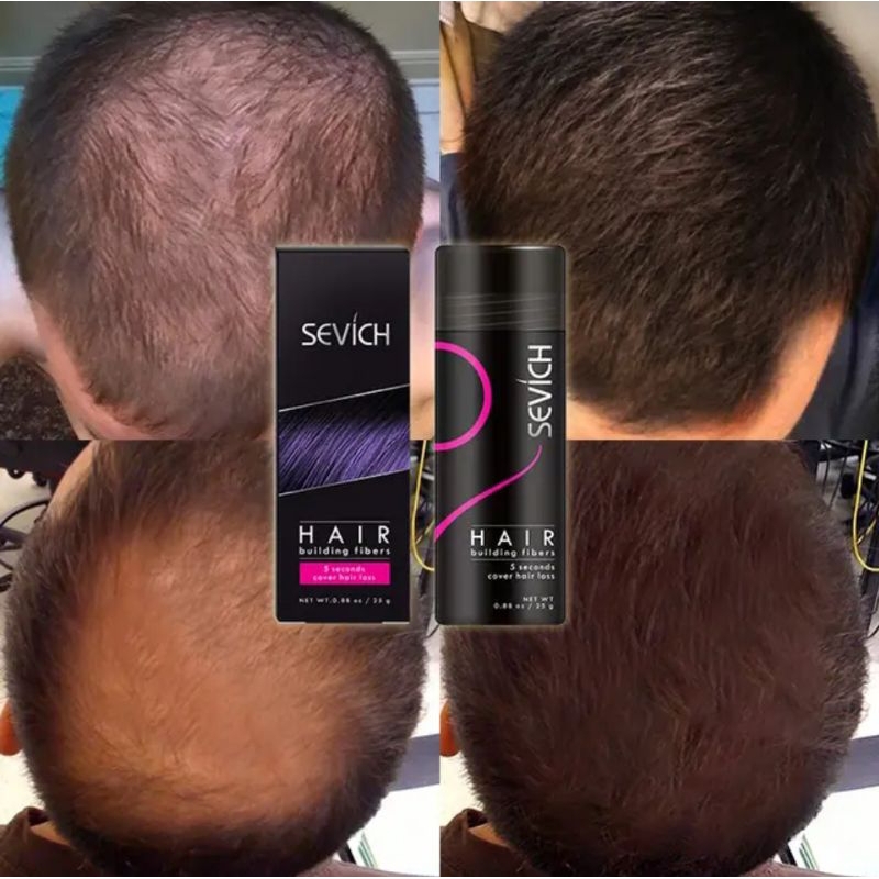 Jual Sevich Hair Building Fibers Penebal Rambut Instan untuk Kebotakan