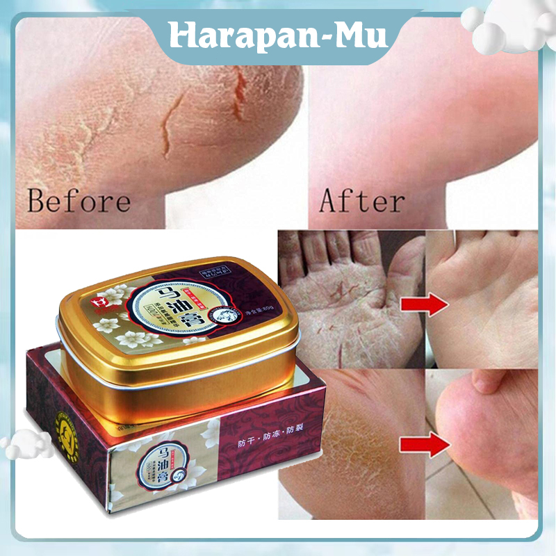 Jual 80g Minyak Kuda Hand Cream Obat Kaki Pecah Dan Kering Penghalus Tumit Oles Kulit Tangan