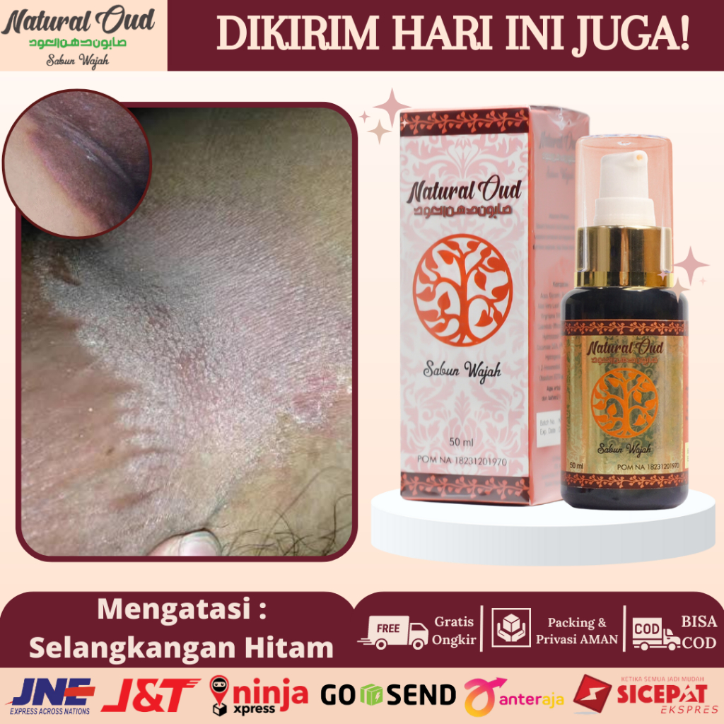 Jual Obat Tinea Curris Obat Jamur Di Selangkangan Selangkangan