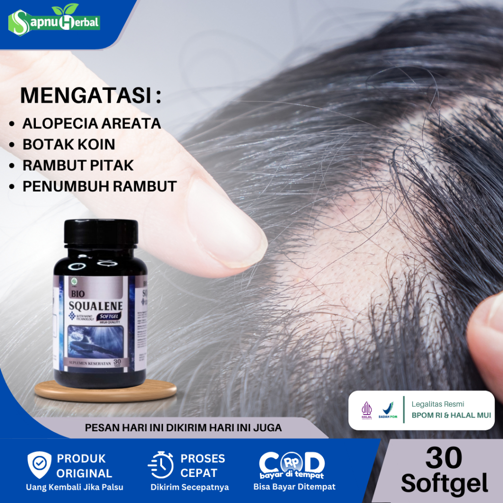 Jual Bio Squalene - Obat Alopecia Areata, Obat Penumbuh Rambut Botak ...