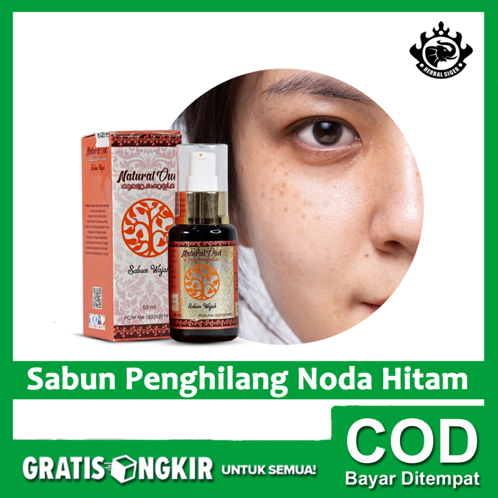 Jual Obat Penghilang Noda Hitam Flek Hitam Bercak Hitam Di Wajah Herbal ...