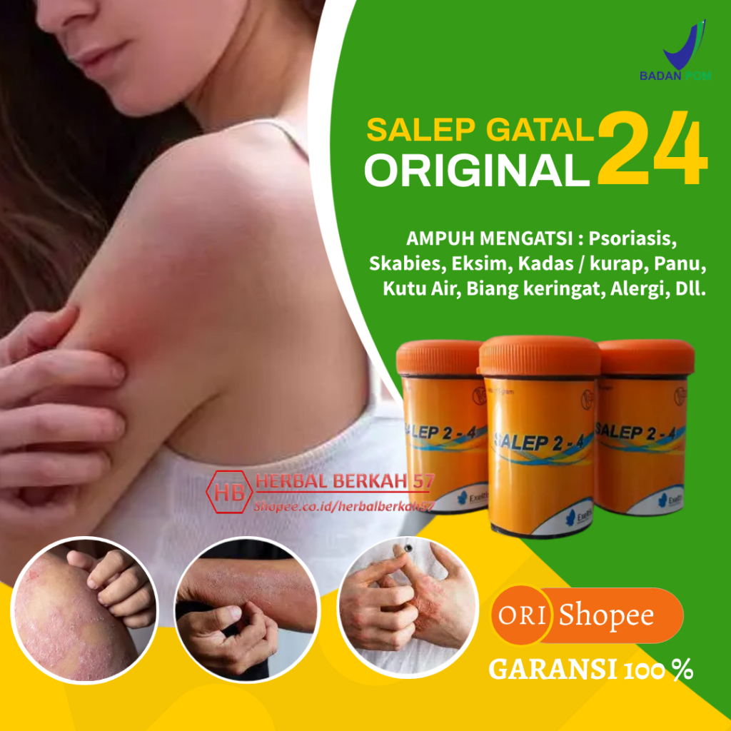 Jual Salep Zwafel 24 Original Gatal Scabies Obat Asli Gatel Panu