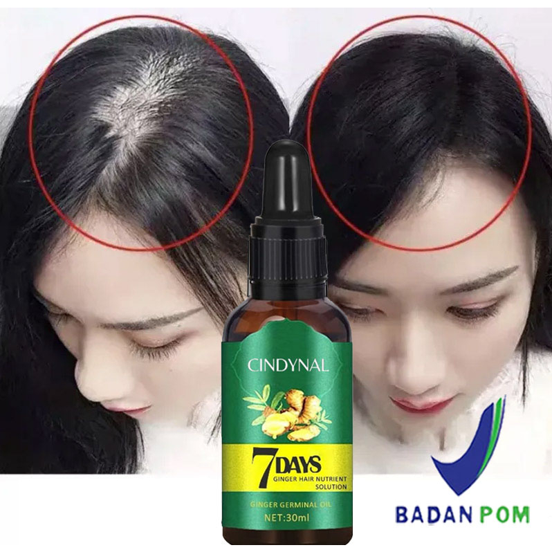 Jual BPOM CINDYNAL 7days Clothes Of skin Essence Minyak Penumbuh Rambut