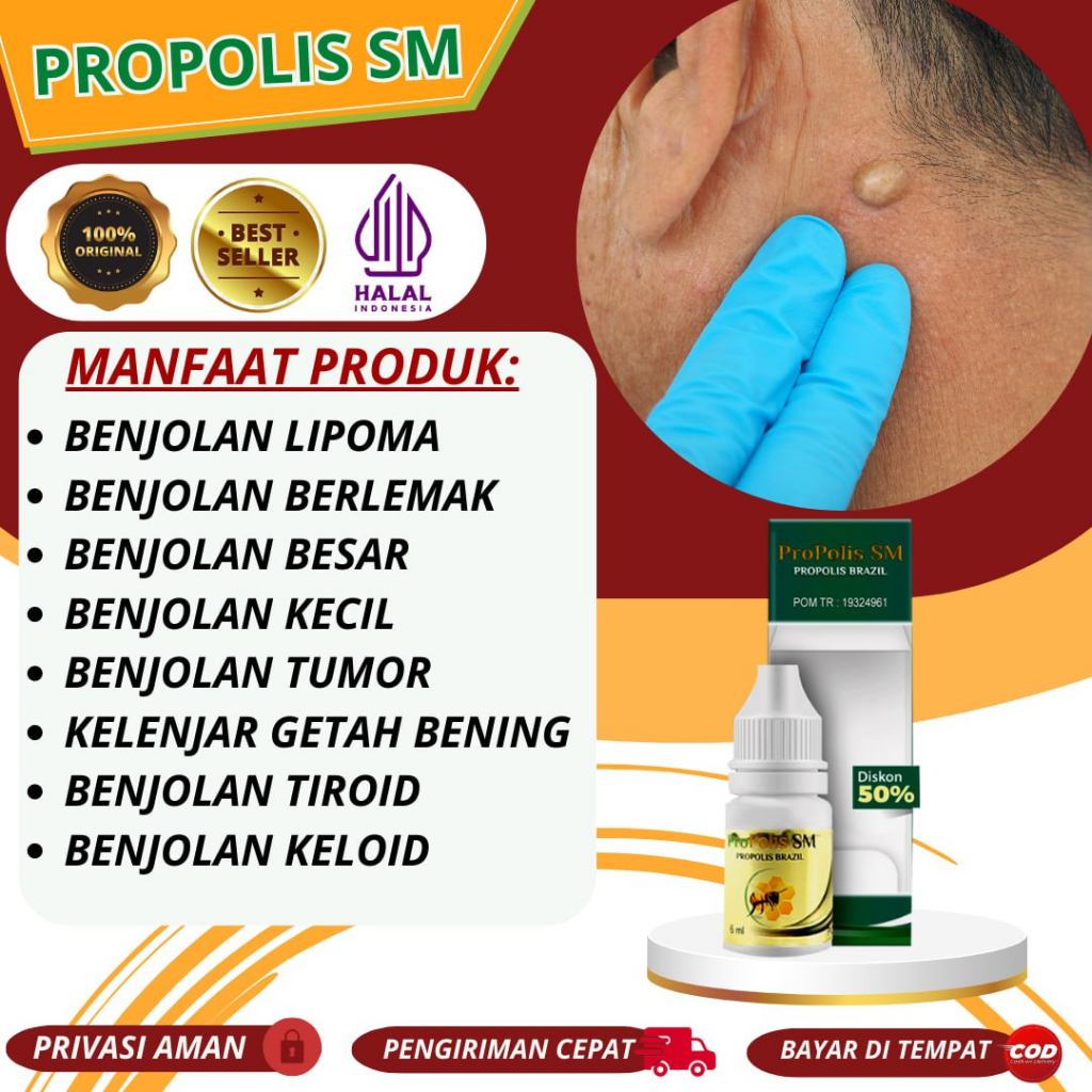 Jual Obat Lipoma - Benjolan Di Punggung, Benjolan Di Paha, Benjolan Di ...