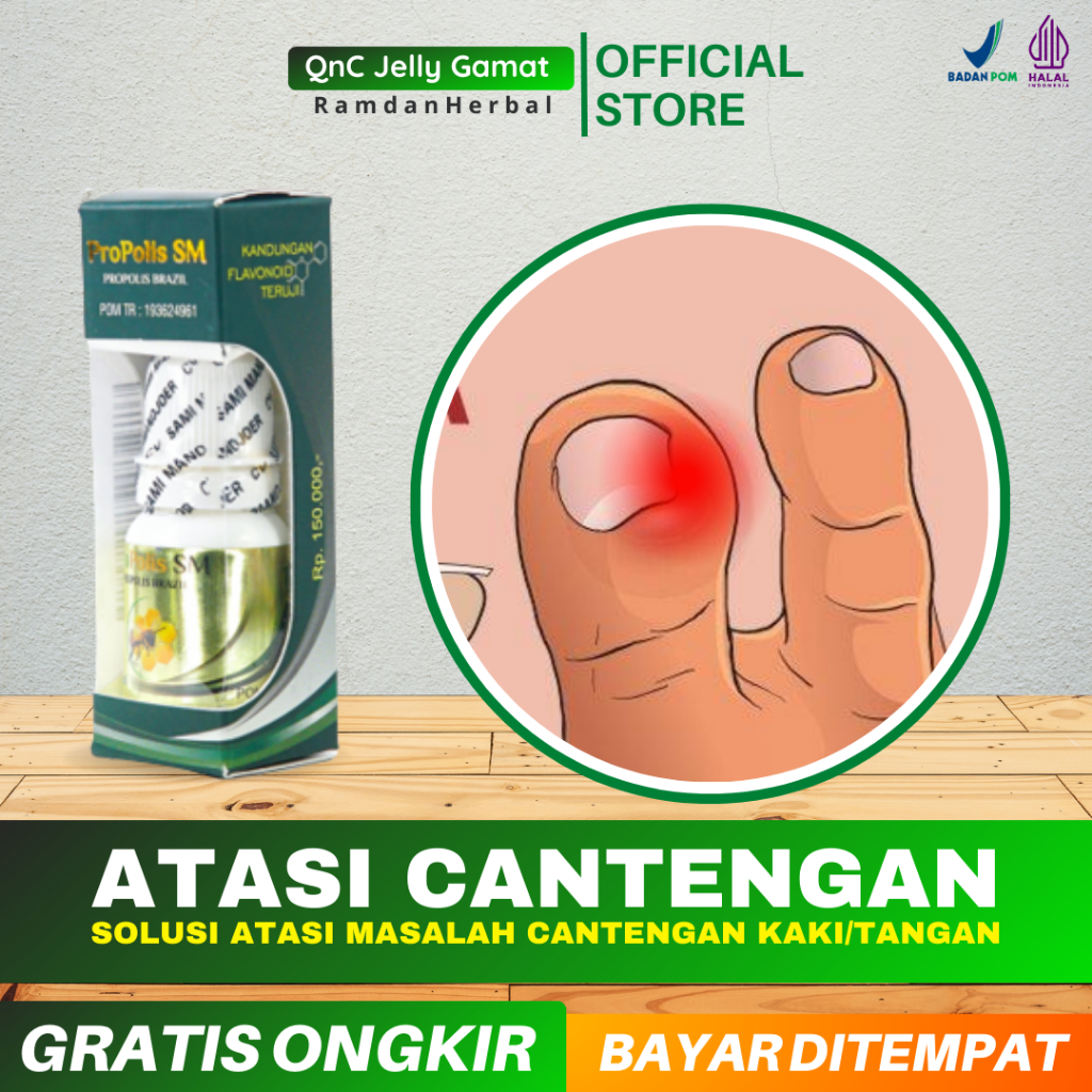 Jual Obat Cantengan Bernanah Jempol Kaki Cantengan Kuku Jempol Kaki