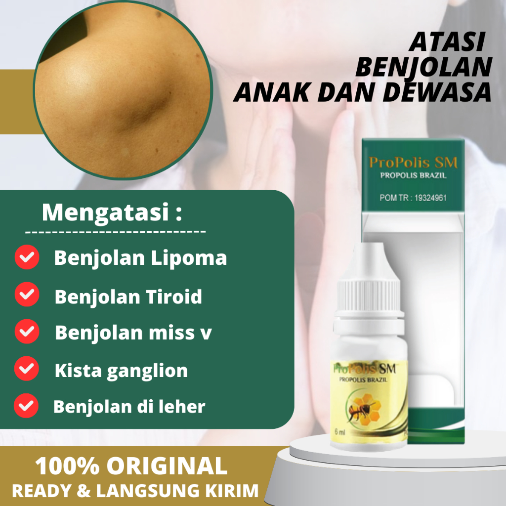 Jual Obat Benjolan Lipoma Penghancur Benjolan Di Leher Kelenjar Getah ...