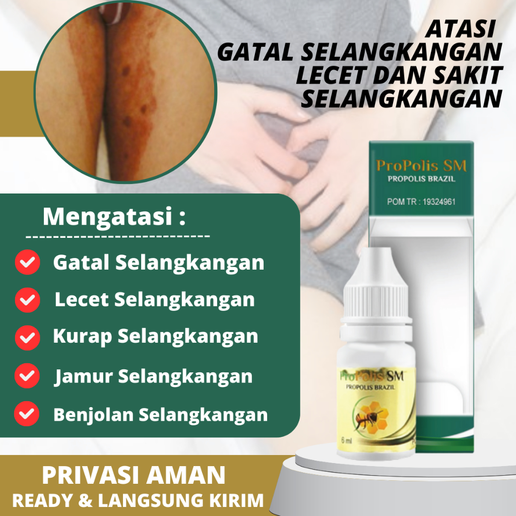 Jual Obat Selangkangan Gatal Dan Hitam Eksim Exim Kering Basah Menahun