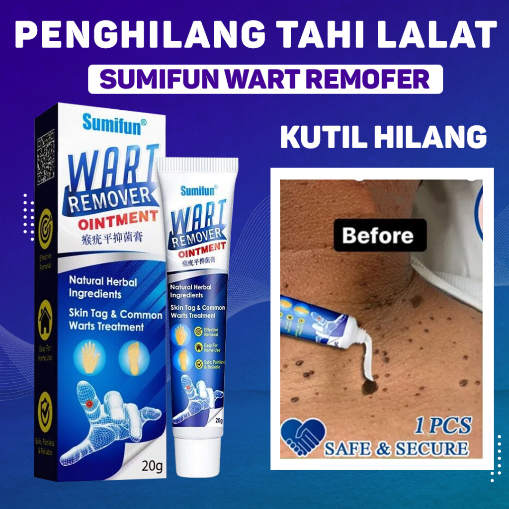 Jual SUMIFUN Wart Remover Ointment alat obat penghilang kutil