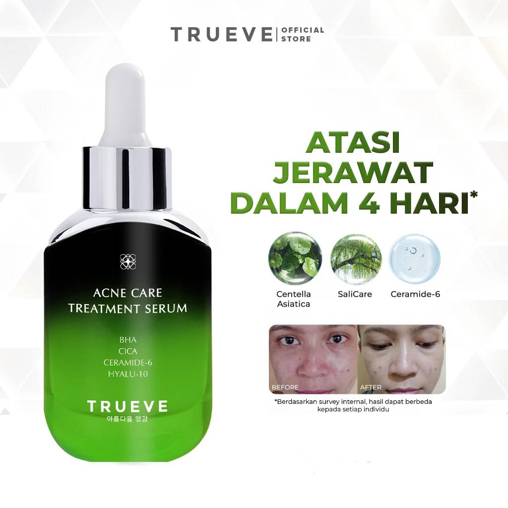 Jual TRUEVE Acne Care Treatment Serum All Size | Shopee Indonesia