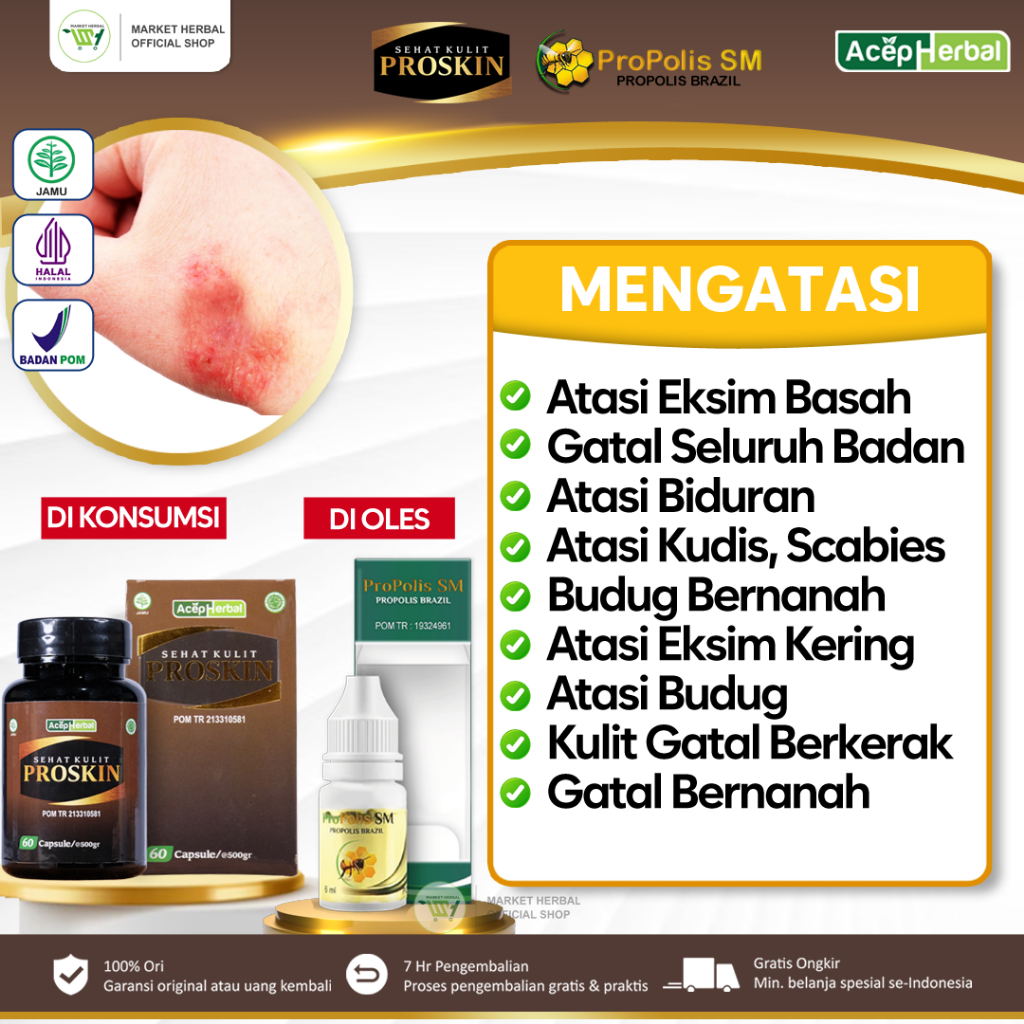 Jual Salep Eksim Basah Scabies Eksim Kering Basah Kurap Kudis Cacar