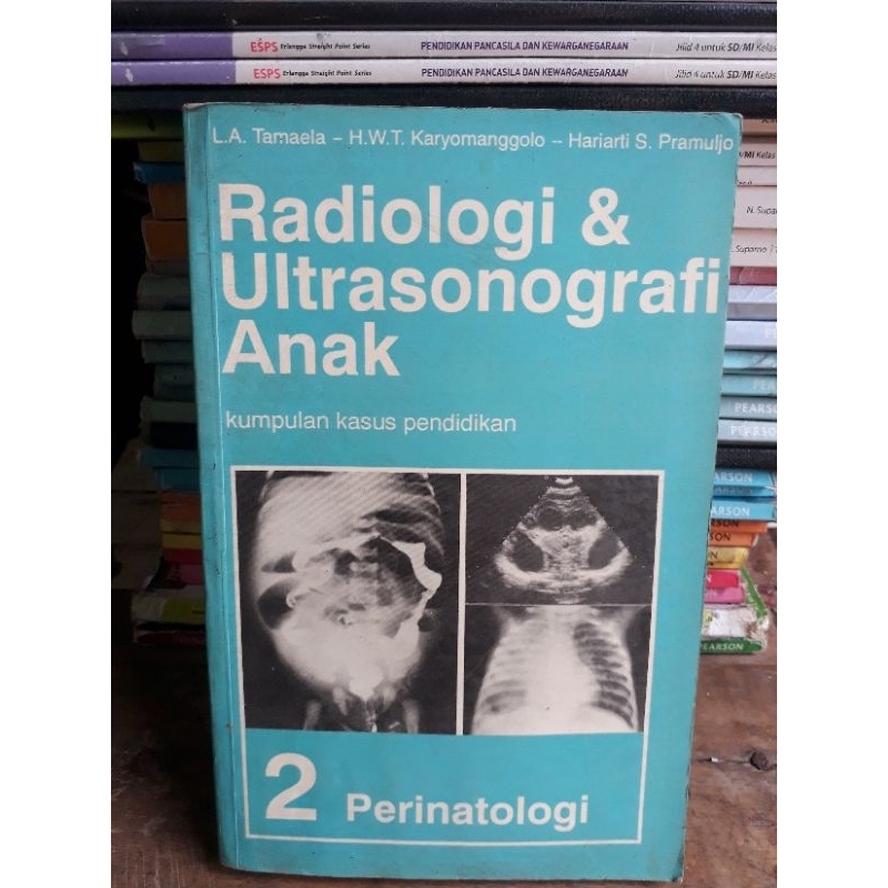 Jual BUKU RADIOLOGI DAN ULTRASONOGRAFI ANAK 2 PERINATOLOGI | Shopee ...