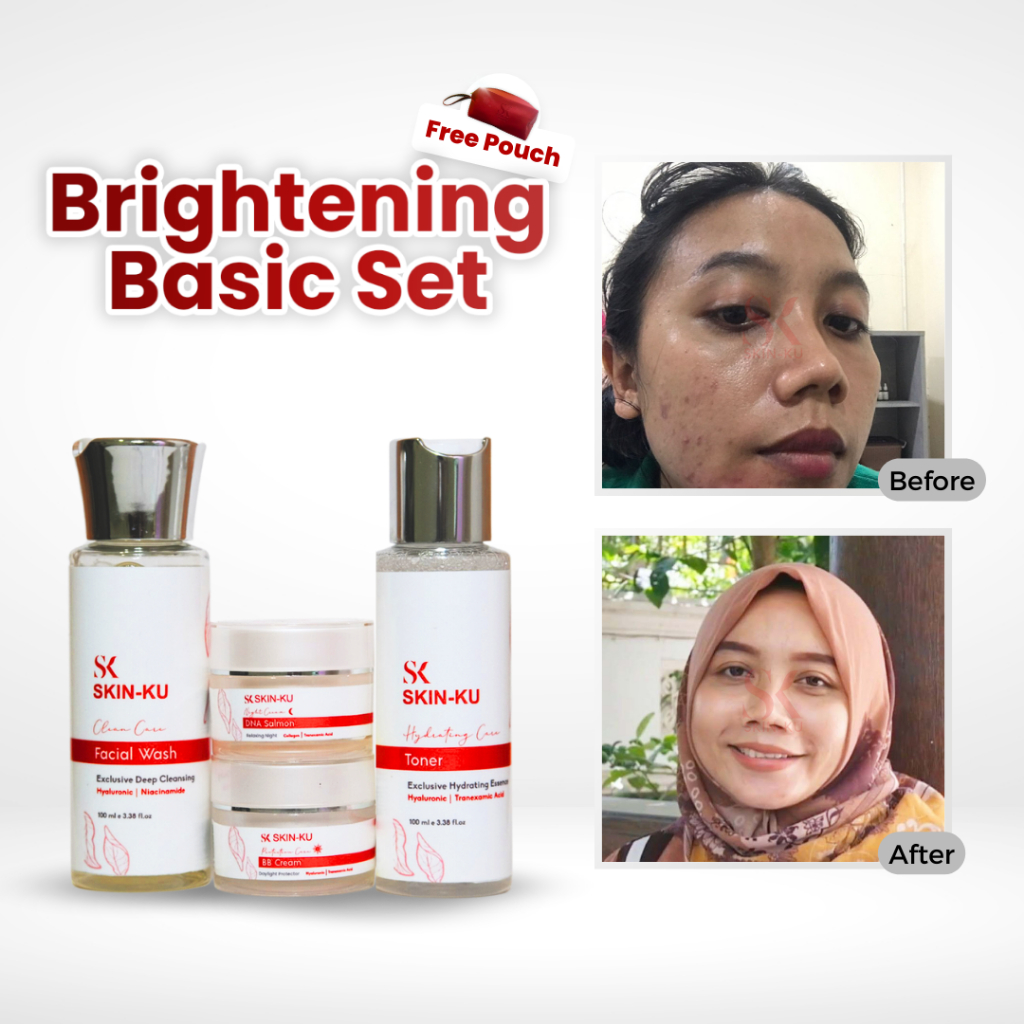 Jual Skincare Paket Basic Brightening (BPOM) untuk kulit kusam/kering