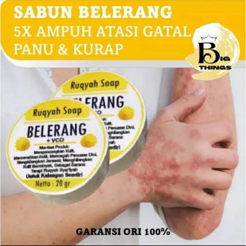 Jual JIE JIE STORE [20gram] Sabun Mandi Sulfur Belerang / Obat Gatal