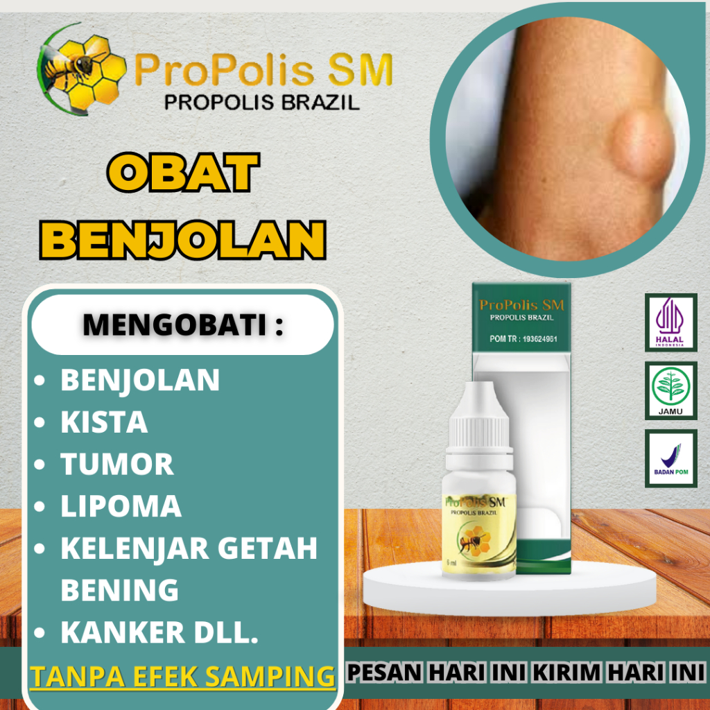 Jual Propolis Sm Obat Benjolan Tidak Normal Uci Uci Benjolan Di Paha Benjolan Tangan