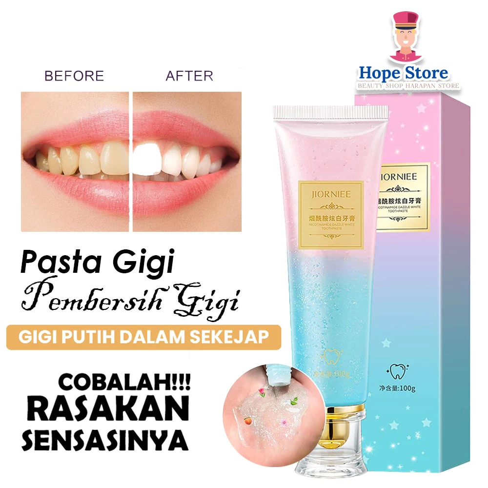 Jiorniee Toothpaste Odol Pemutih Gigi dan Karang Gigi / Menghilangkan Bau Mulut | AutoStock