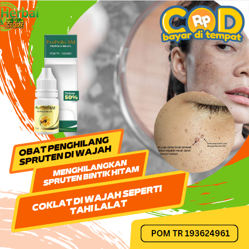 Jual Obat Penghilang Spruten Di Wajah, Salep Menghilangkan Spruten ...