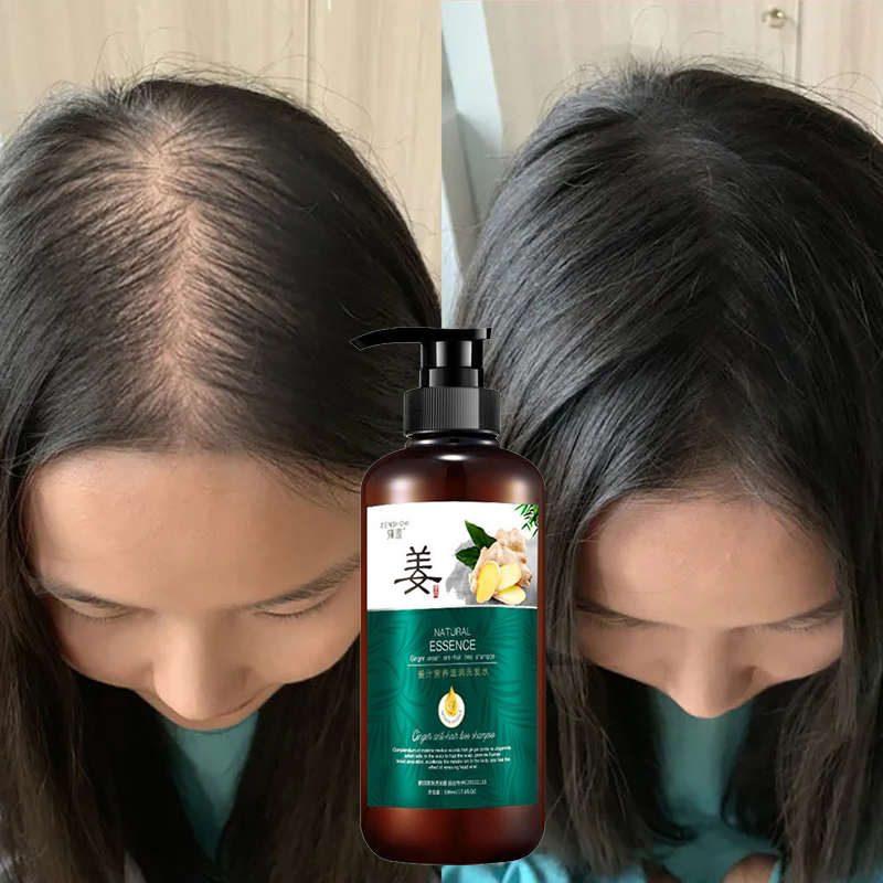 Jual Ginger Juice Hair Growth Shampoo Anti Hair Loss Shampoo Promotes