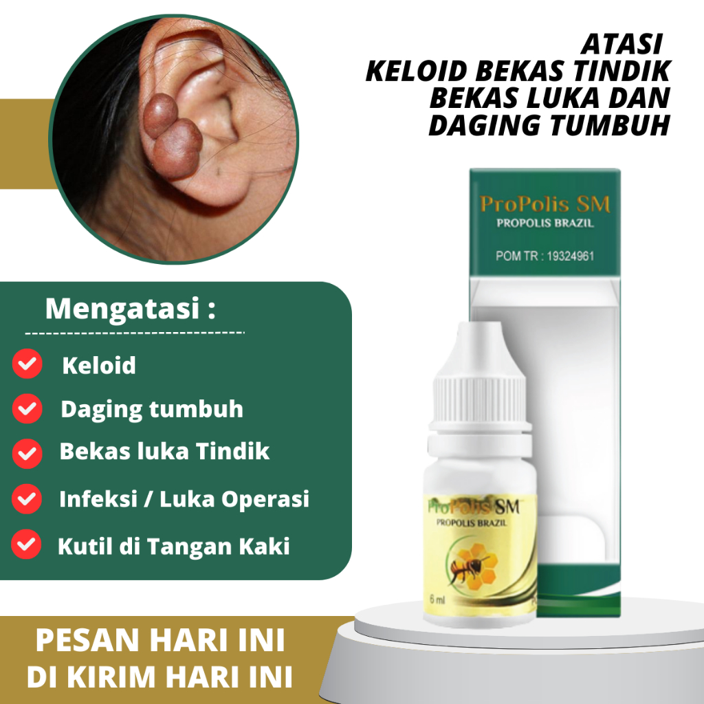 Jual Obat Keloid Luka Tindik, Penumpas Daging tumbuh, Penghilang bekas