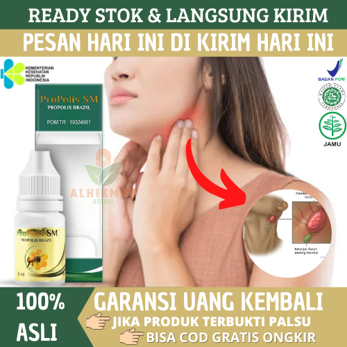 Jual Obat Tb Kelenjar Obat Kelenjar Getah Bening Benjolan Di Leher