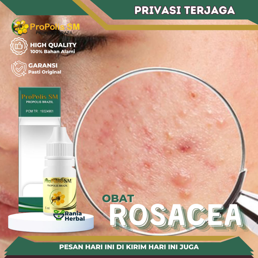 Jual Obat Rosacea Obat Kulit Kemerahan Peradangan Kulit Obat