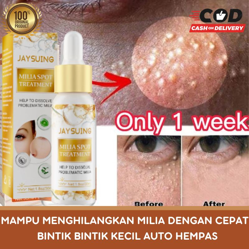 Jual Obat salep cream krim penghilang milia remover pada wajah paling