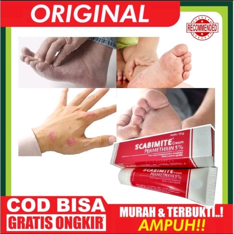 Jual Scabimite Blacksoap Sabun Gatal Gudiken | Shopee Indonesia