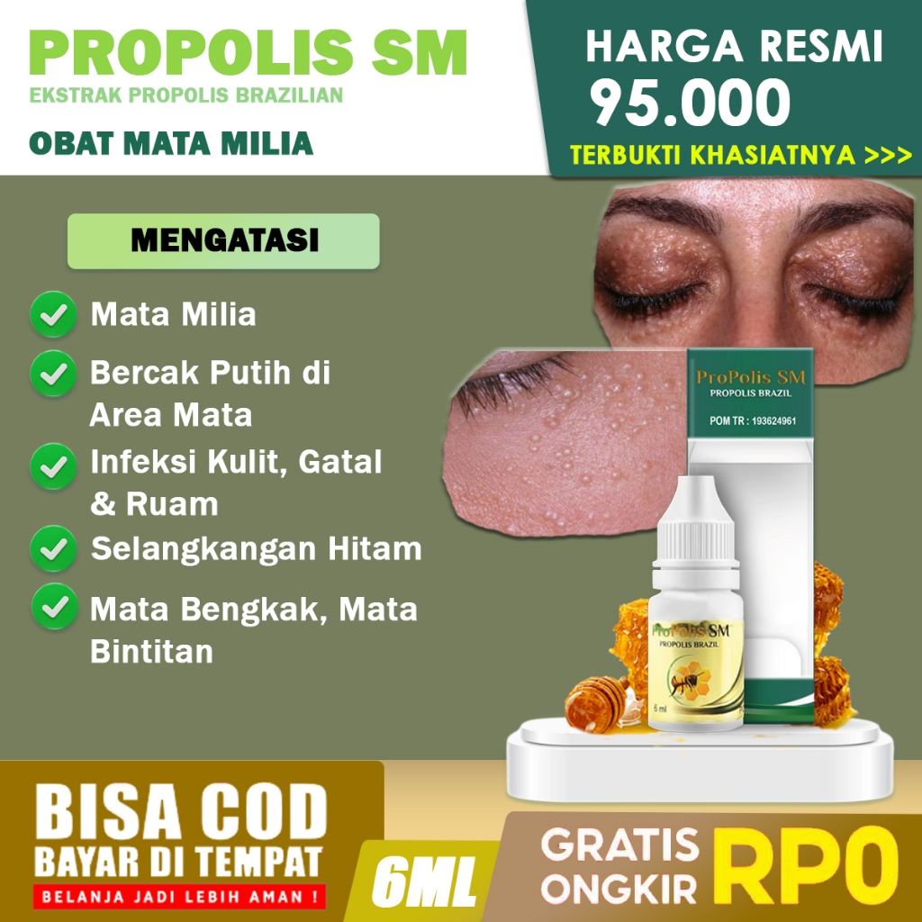 Jual Obat Mata Milia Penghilang Bintik Putih Di Bawah Mata Obat Milia