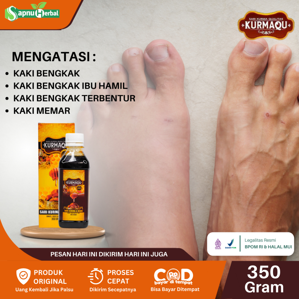 Jual Obat Kaki Bengkak Pengempis Kaki Bengkak Obat Kaki Bengkak