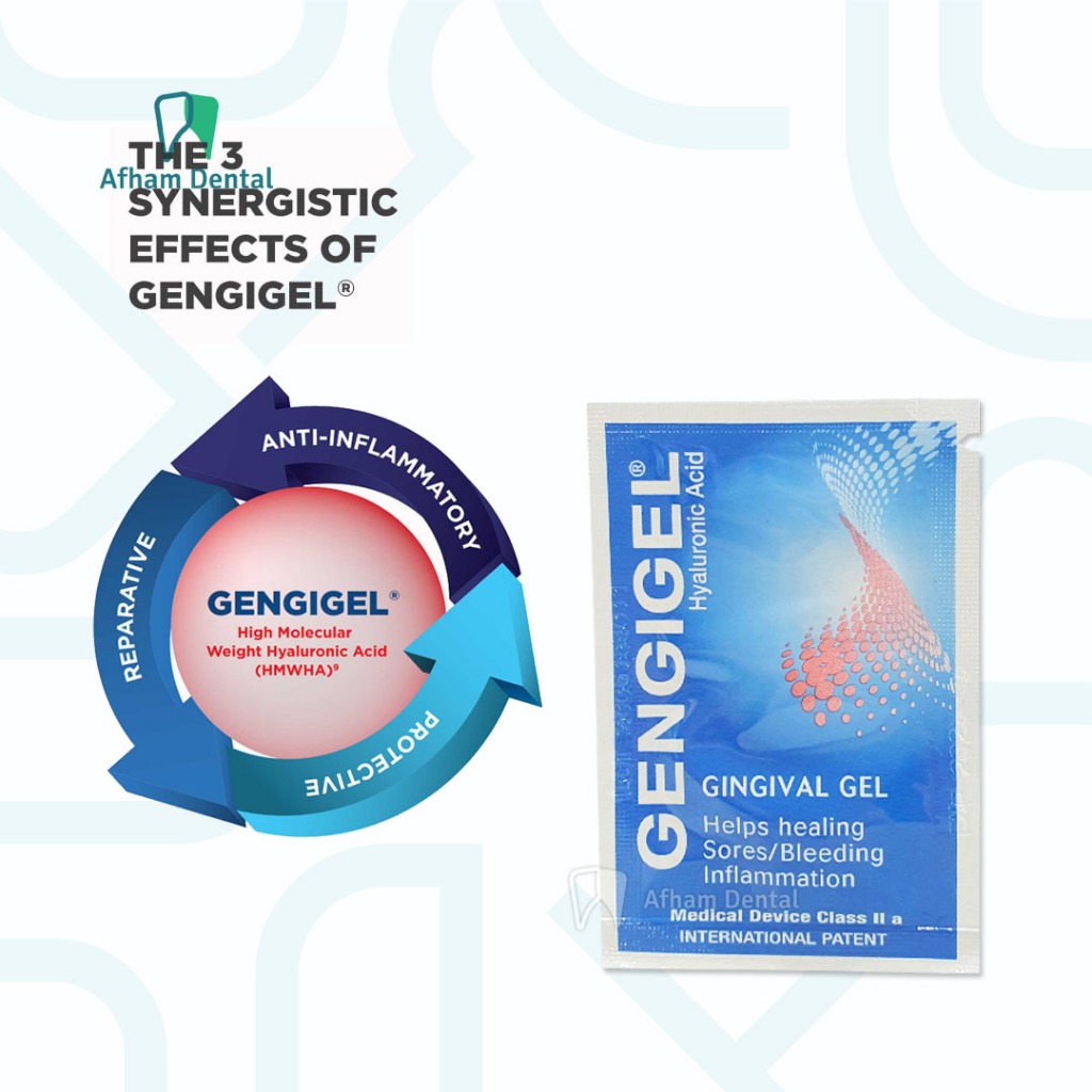 Jual GENGIGEL SACHET 1ML GINGIVAL GEL SASET ORIGINAL / OBAT SARIAWAN ...