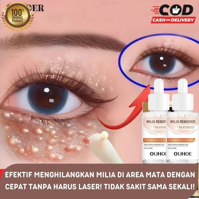 Jual 7 days Serum Penghilang Milia Kutil di bawah Mata Eye Milia