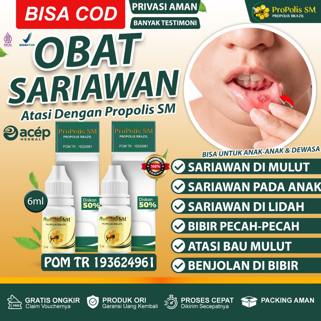 Jual Obat Sariawan Di Bibir Mulut Lidah Atasi Bau Mulut Tak Sedap Bibir