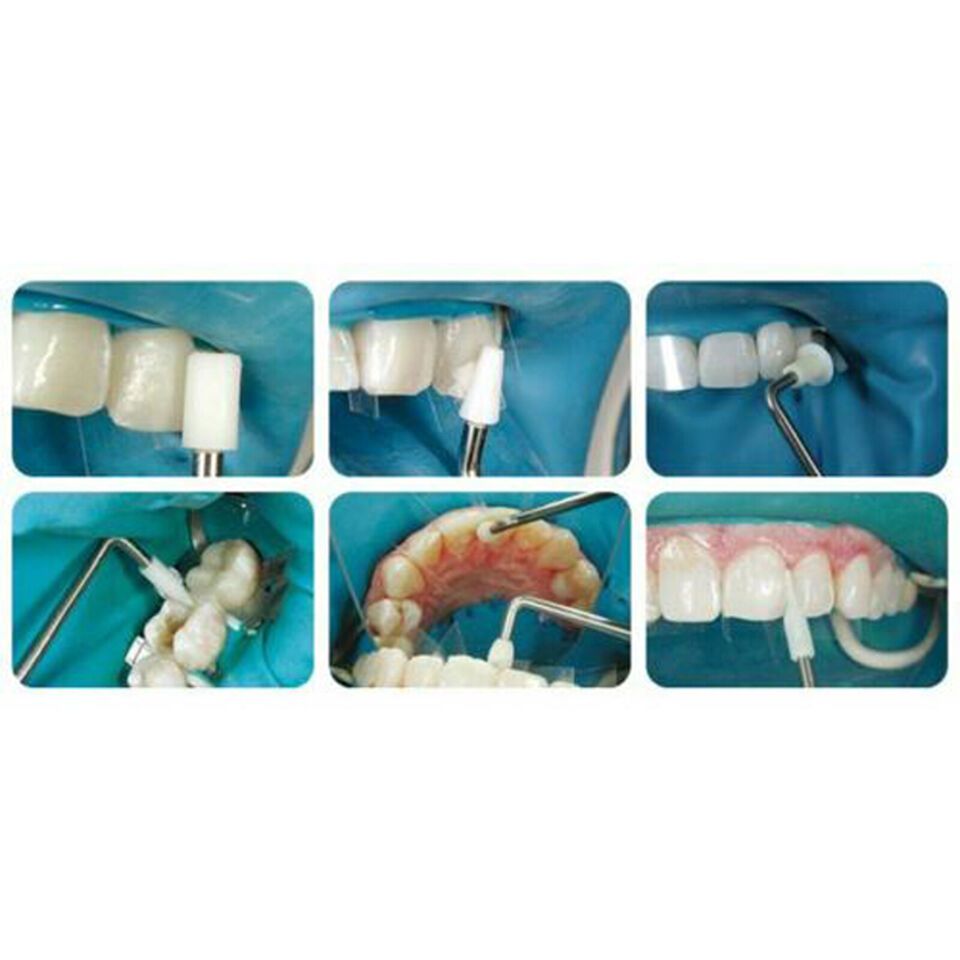 Jual Dental Kerr CompoRoller Composite Modeling Instrument Assorted Kit ...