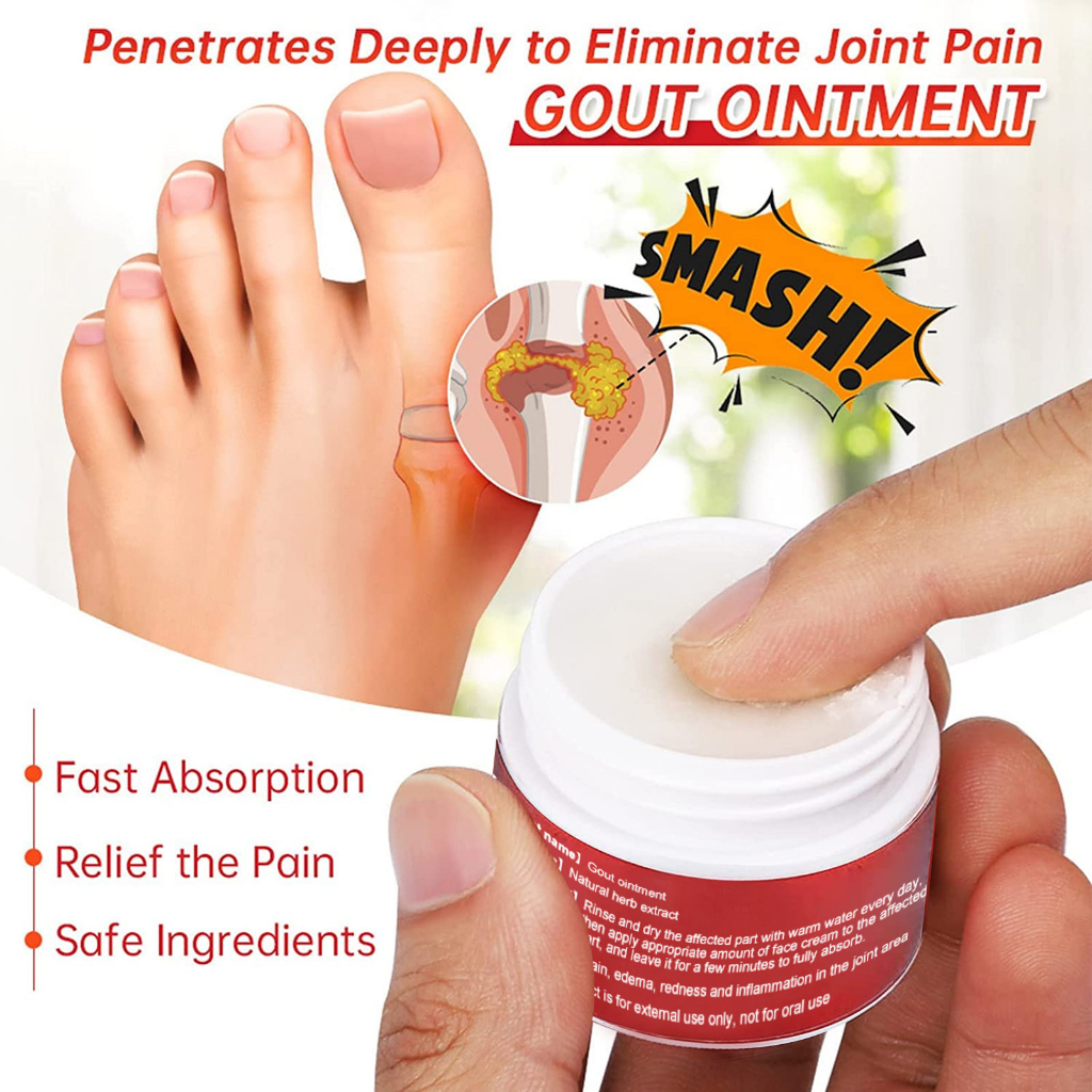 Jual South Moon Bunion Pain Relief Cream Gout Ointment Cream Krim Untuk Nyeri Sendi Otot
