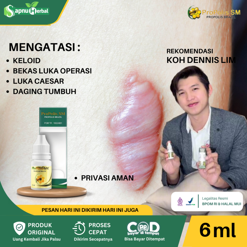 Jual Propolis Sm Obat Penghilang Keloid Obat Penghilang Bekas Luka