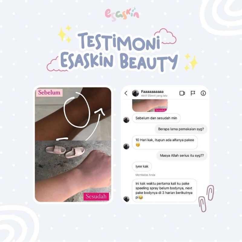 Jual [𝐑𝐄𝐀𝐃𝐘 𝐒𝐓𝐎𝐊 𝐒𝐈𝐀𝐏 𝐊𝐈𝐑𝐈𝐌] Esaskin Beauty Peeling Spray & Whitening ...
