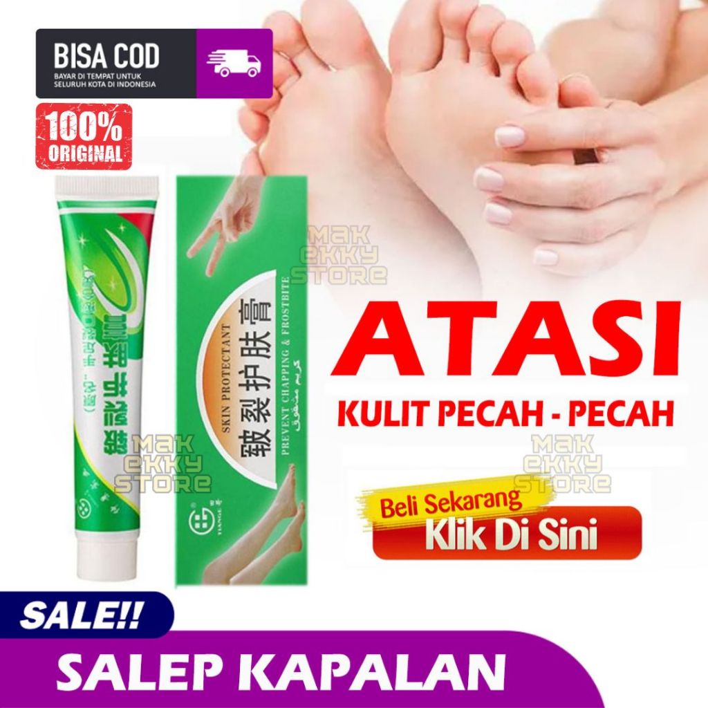 Jual SALEP KAKI PECAH PECAH KERING KAPALAN TIANGE - SALEP CHINA KAKI ...