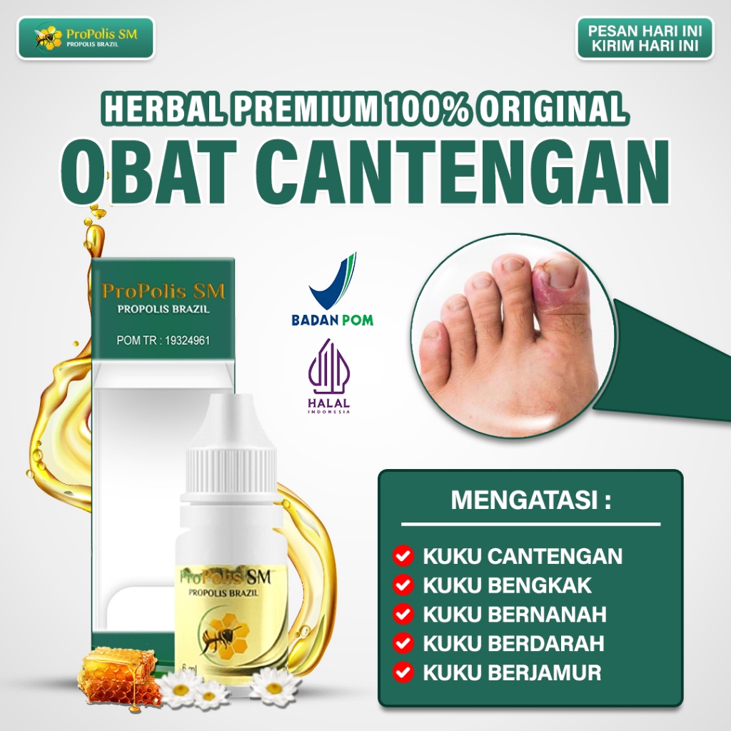 Jual Obat Cantengan Di Jempol Kaki Kuku Rusak Bengkak Bernanah Bau