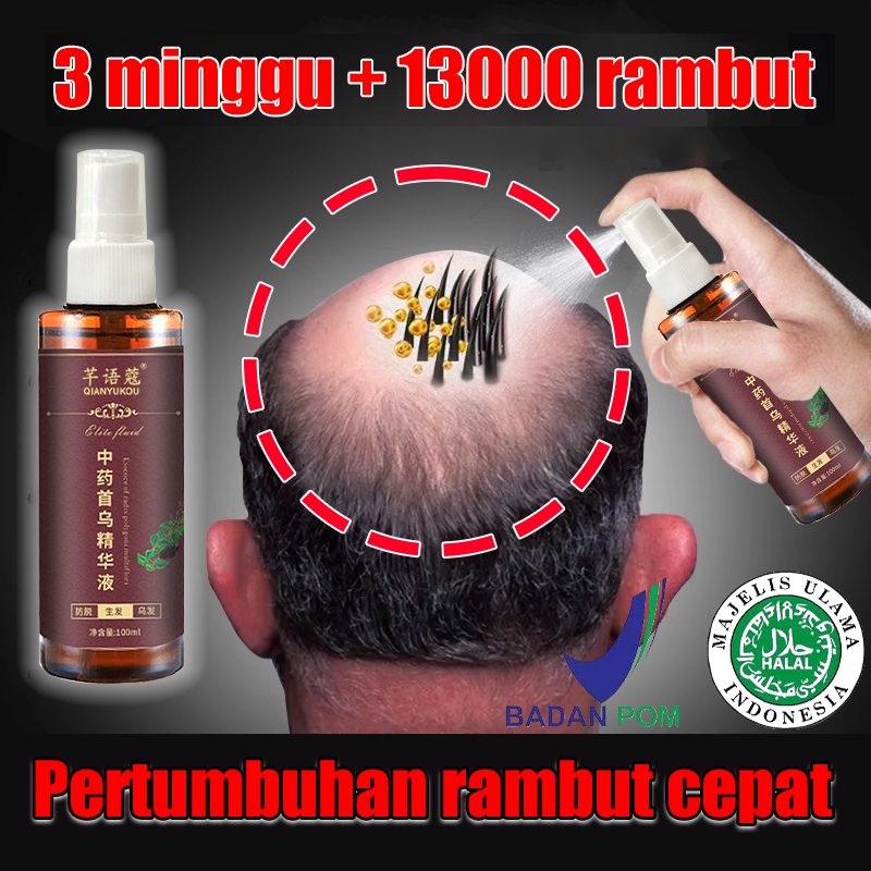 Jual Serum Penumbuh Rambut Botak Super Cepat Obat Penumbuh Rambut 100ml ...