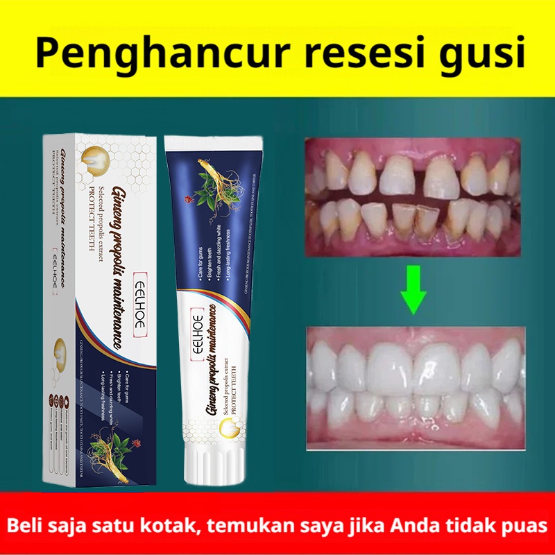Jual ⚡️COD+GRATIS ONGKIR⚡️Pasta Gigi Perawatan Gigi Longgar Ginseng
