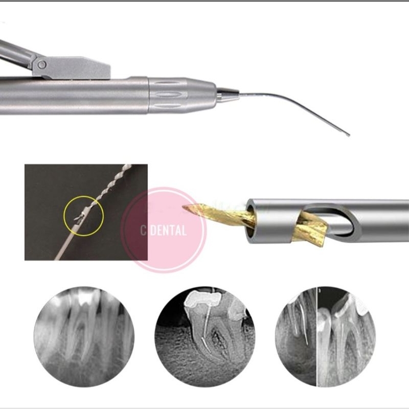 Jual Dental Endo Broken File Removal Retriever Pen Clamping Type Complete Set Shopee Indonesia