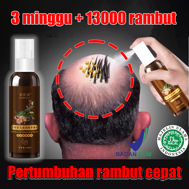 Jual Serum Penumbuh Rambut Botak Super Cepat Obat Penumbuh Rambut 100ml Vitamin Rambut Rontok 7384