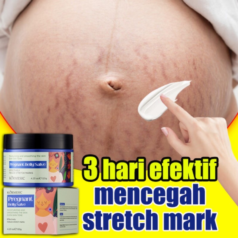 Jual Stretch Mark Cream KORMESIC Cream Streachmark Paling Ampuh 120g
