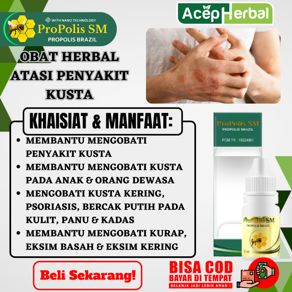 Jual Obat Penyakit Kusta - Obat Kusta, Obat Kusta, Obat Kusta, Obat ...