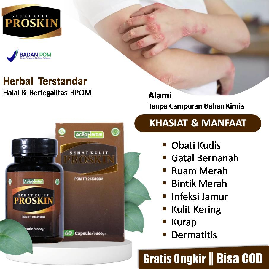 Jual Obat Kudis, Gatal Bernanah, Ruam Merah, Bintik Merah, Infeksi ...