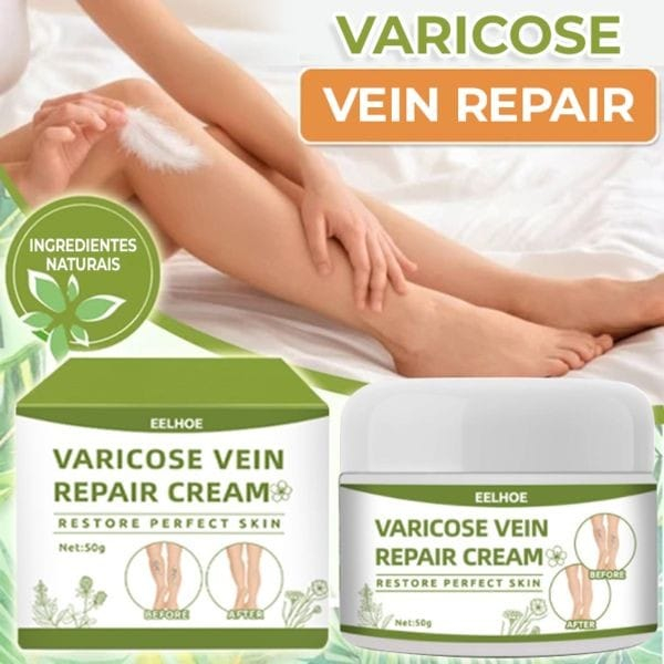 Jual Eelhoe Varicose Veins Cream Krim Efektif Penghilang Varises Di