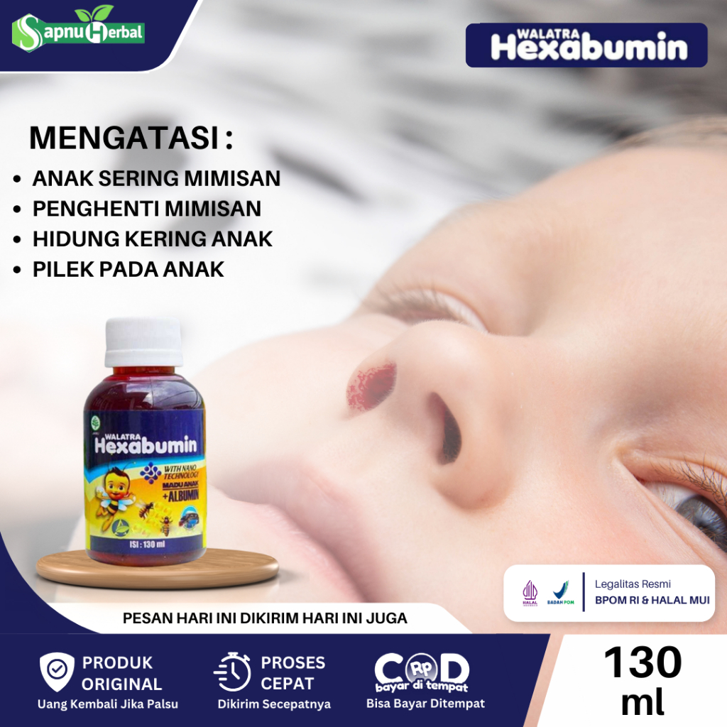 Jual Obat Anak Mimisan, Anak Sering Mimisan, Mimisan Anak, Mimisan Terus Menerus, Pendarahan