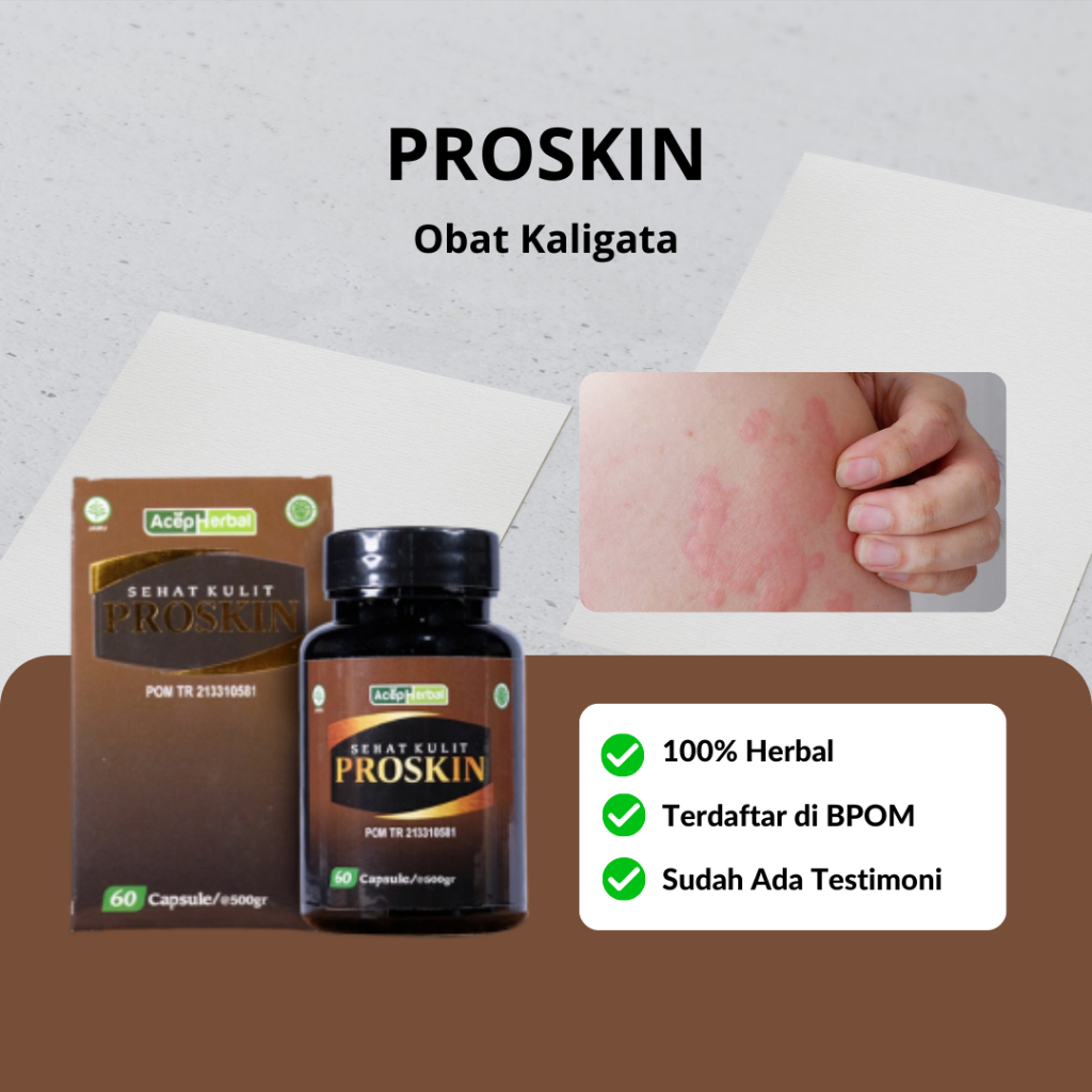 Jual Proskin Obat Kaligata Gatal Seluruh Badan Bentol Bentol Di Kulit Obat Kaligata Untuk 5191