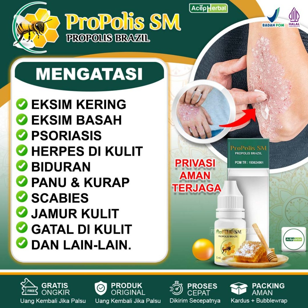 Jual Obat Eksim Kering Eksim Basah Psoriasis Herpes Di Kulit Biduran