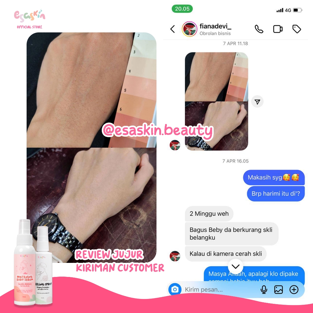 Jual Esaskin (Bundling Belanja Hemat) - Ampuh Cerahkan Kulit Belang dan ...